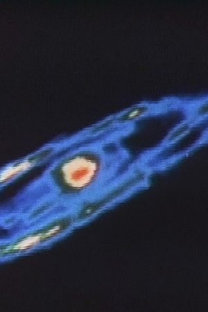 epizoda