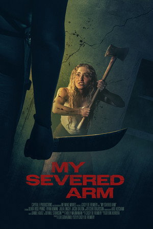 My Severed Arm