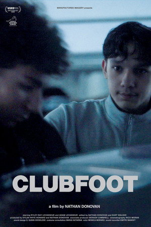 Clubfoot
