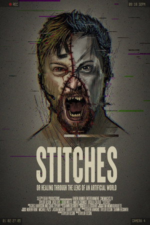 Stitches