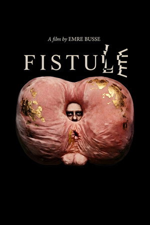 FISTULE
