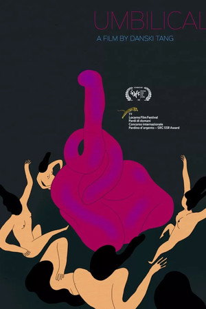 Umbilical