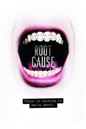 Root Cause Root Cause