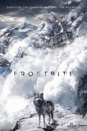 Frostbite