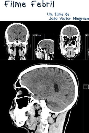Filme Febril