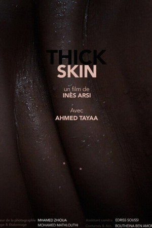 Thick Skin Thick Skin