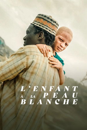 The Boy with White Skin