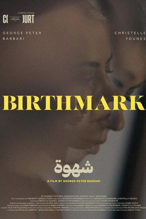 Birthmark Birthmark