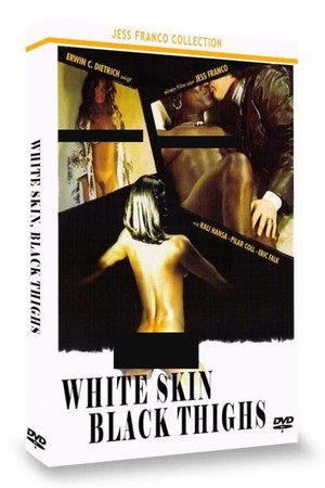Weiße Haut auf schwarzen Schenkeln Weiße Haut auf schwarzen Schenkeln