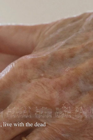Skin Skin