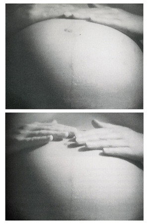 Antepartum poster