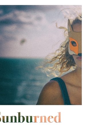 Sunburned