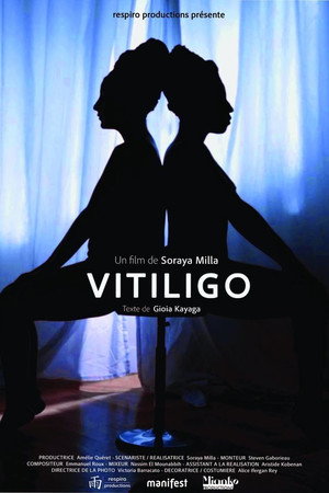 Vitiligo poster