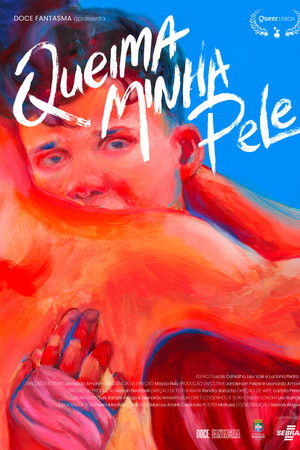 Queima Minha Pele