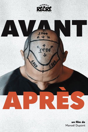 Avant/Après