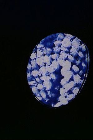 Eyewash (Alternate Version)