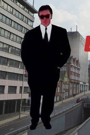 Heart Bypass: Birmingham