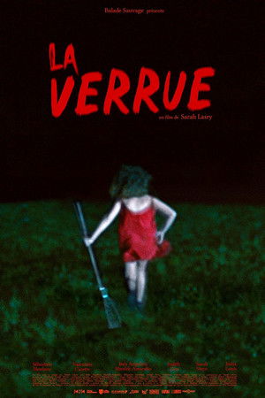 La verrue