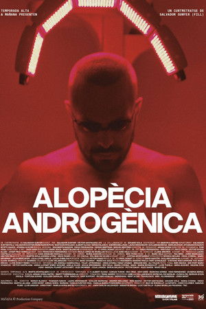 Alopècia androgènica