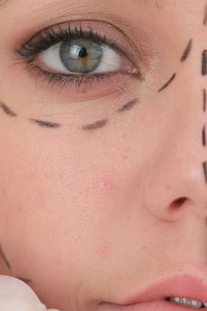 Plastic Surgery Knifemares