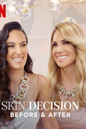 Skin Decision: Before and After