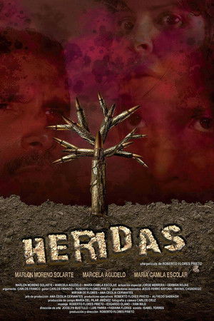 Heridas