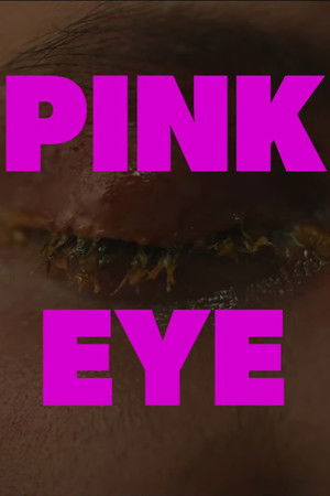 Pink Eye Pink Eye
