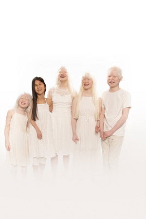 Born with Albinism Born with Albinism