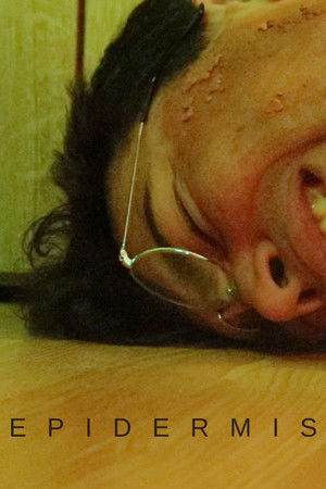 Epidermis