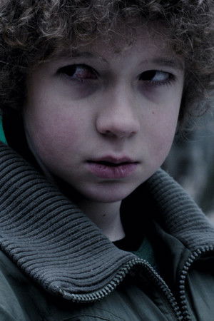 Rote Flecken Rote Flecken