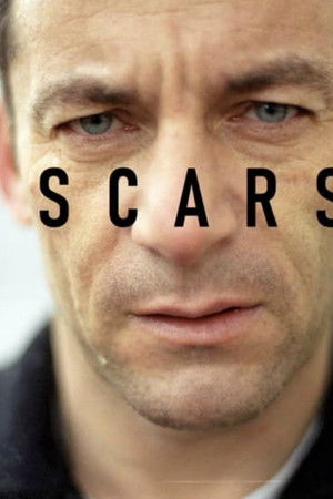 Scars Scars