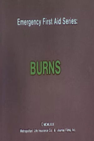 Emergency First Aid Series: Burns Emergency First Aid Series: Burns