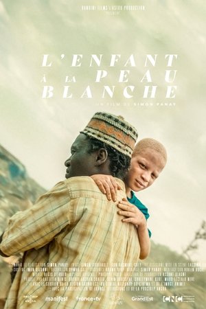 The Boy with White Skin The Boy with White Skin