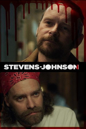 Stevens Johnson Stevens Johnson