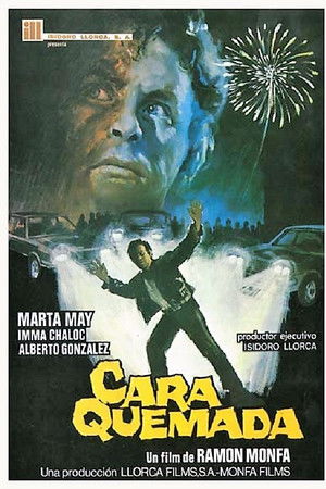 Cara quemada Cara quemada