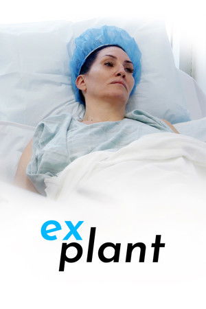 Explant Explant