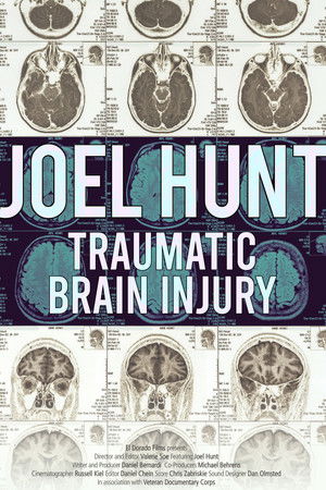 Joel Hunt: Traumatic Brain Injury (TBI)
