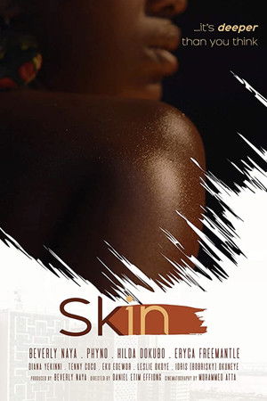 Skin Skin