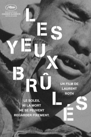 Les yeux brûlés Les yeux brûlés