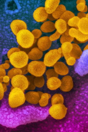 Did Covid Leak from a Lab in China? Did Covid Leak from a Lab in China?