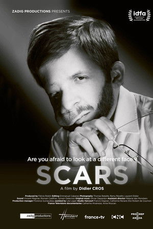 Scars Scars