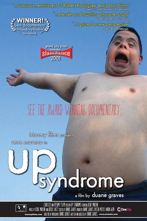 Up Syndrome Up Syndrome