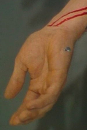 Staging Death Staging Death