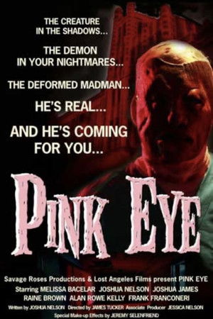 Pink Eye Pink Eye