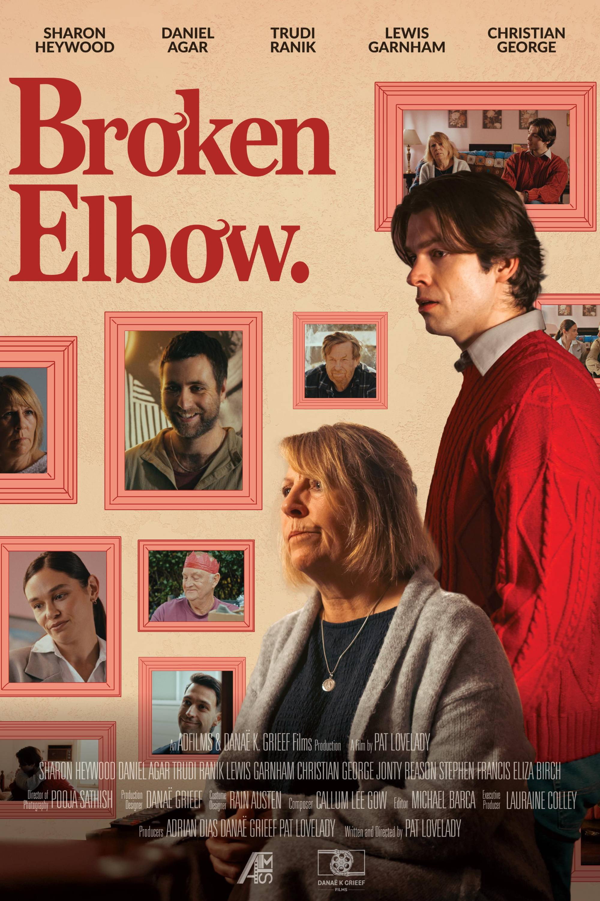 Broken Elbow