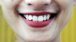 Mouth