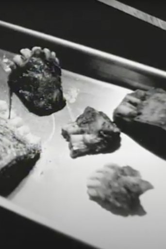 A Primer for Dental Extraction