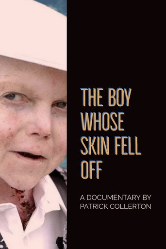 The Boy Whose Skin Fell Off 在线观看和下载完整电影