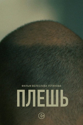 Baldness