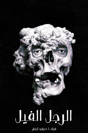 The Elephant Man